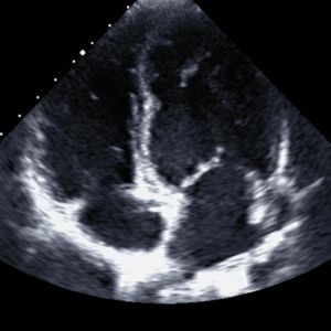 Ultrassom Abdominal