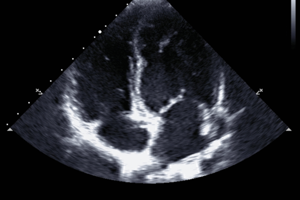 Ultrassom Abdominal